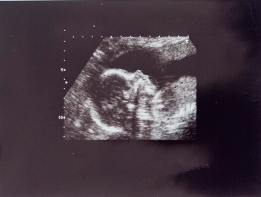 echo foto in zwart wit