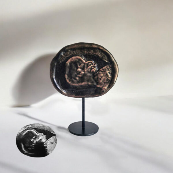 2D echo sterrenkind brons