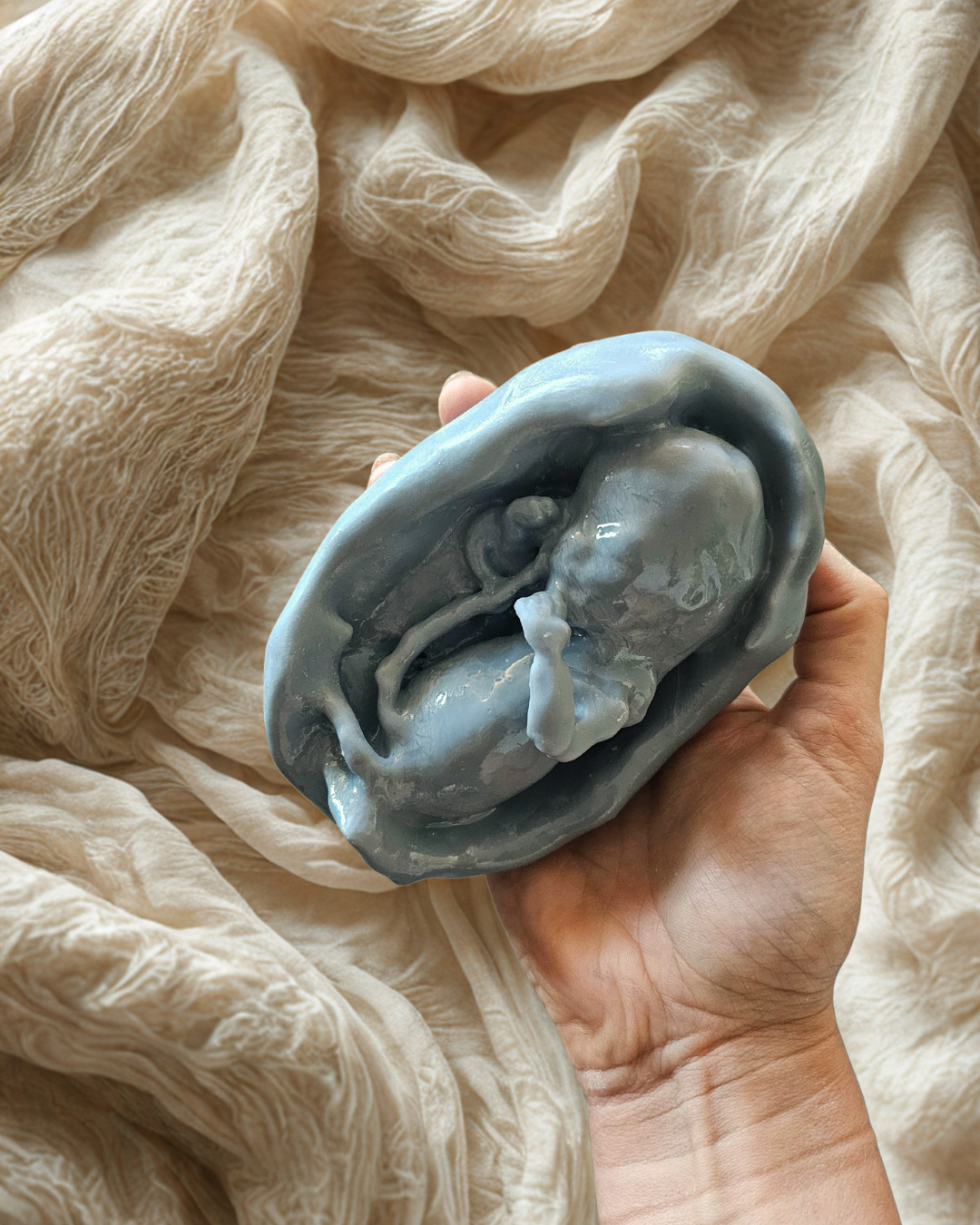 3D echo beeldje Sterrenkindje 2D echo