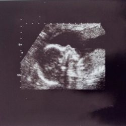 echo foto in zwart wit